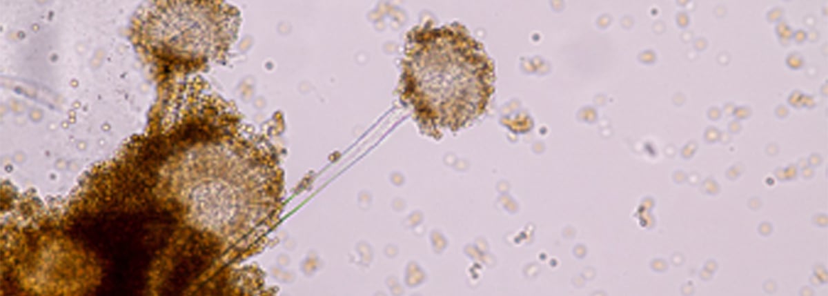 Microorganism Spotlight - Filamentous Organisms